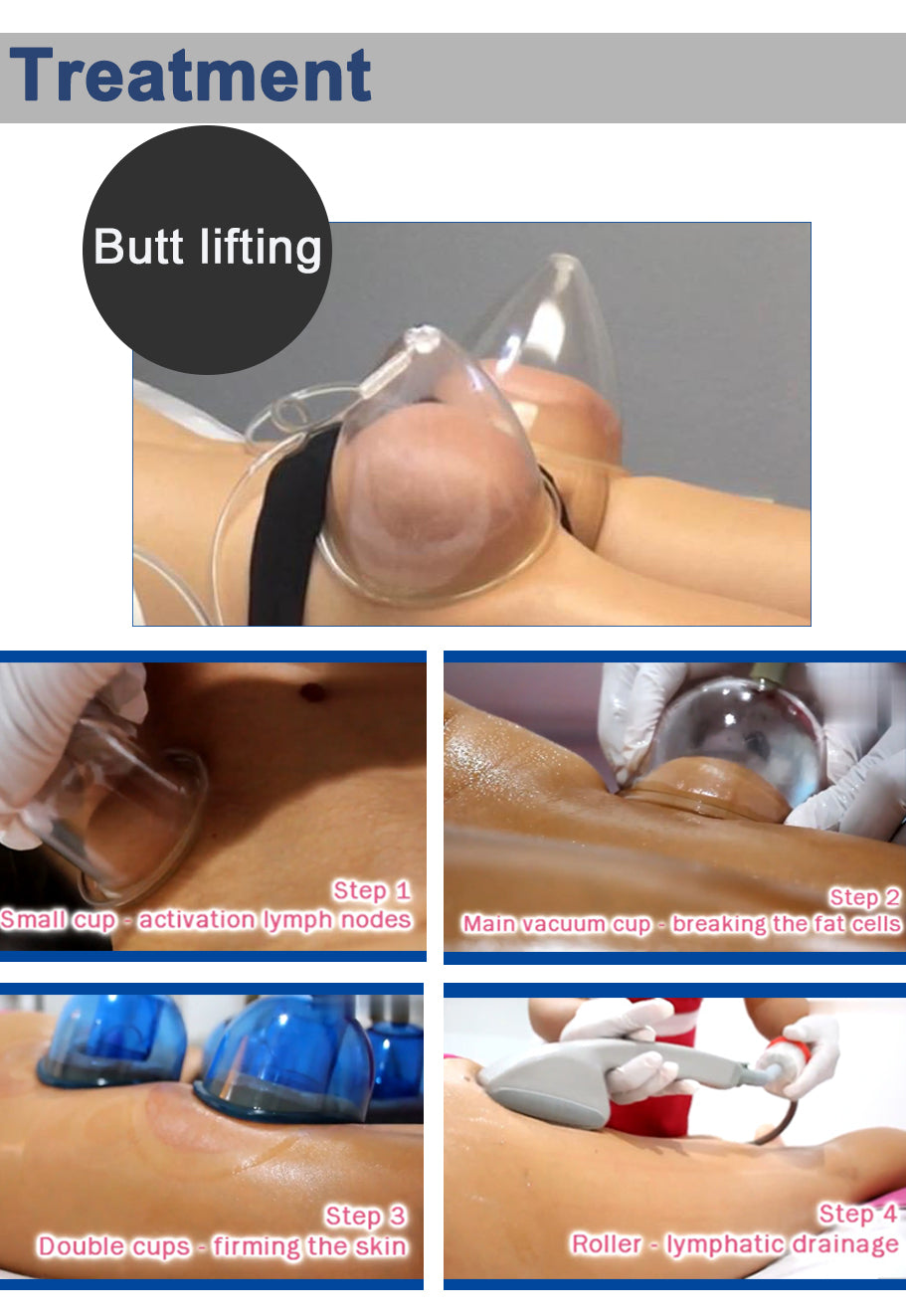 Dispositivo de mejora de glúteos con ventosas para masaje de glúteos