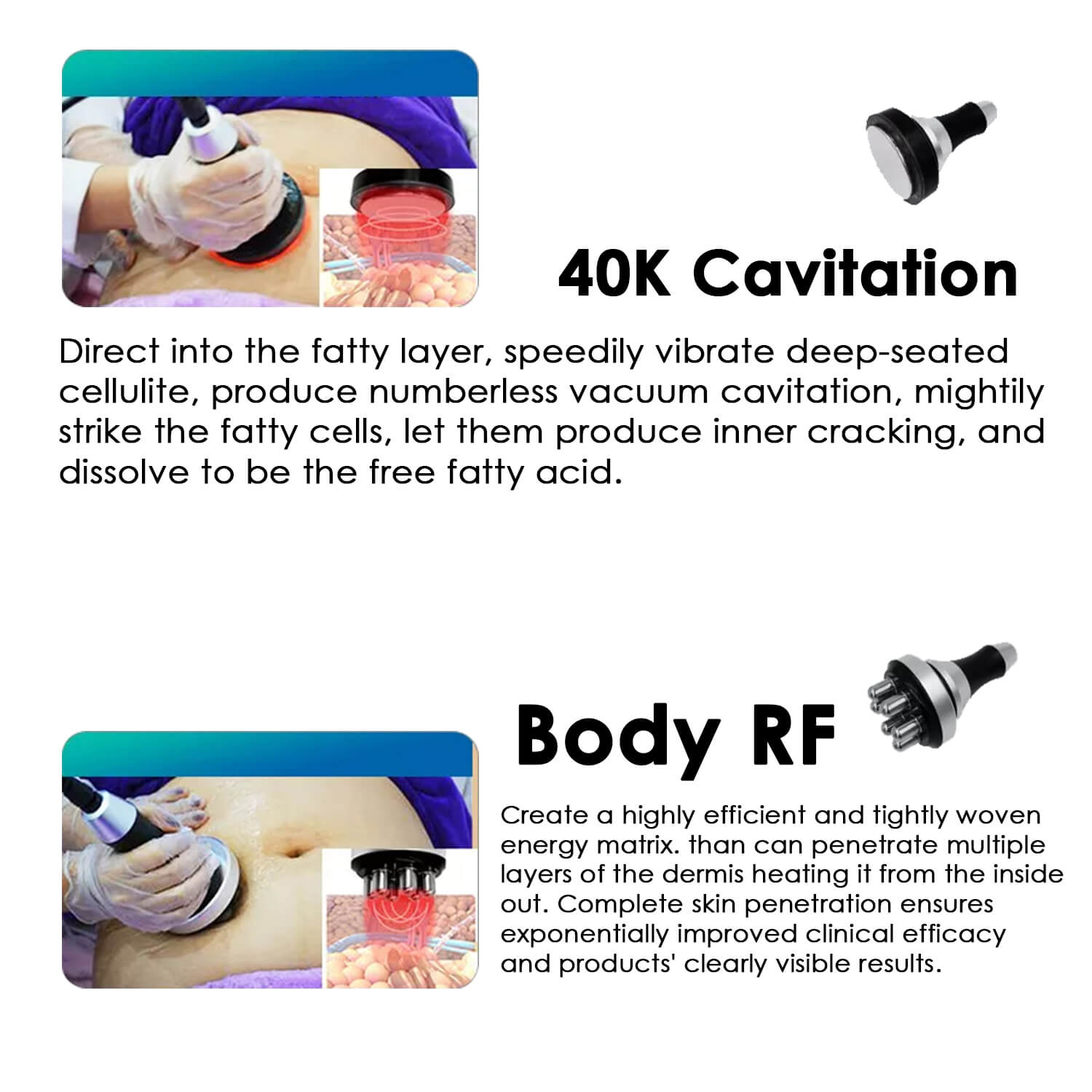 Cryo slimming machine comes with 40k cavitation head and body rf handle