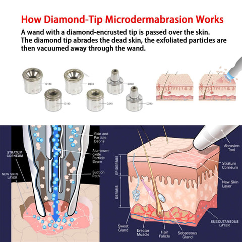 6pcs Dermabrasion Replacement Tips for Microdermabrasion Machine - Lazzybeauty