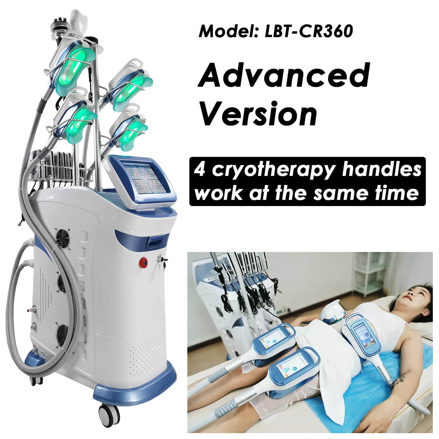 Cryo slimming machine has 4 cooling handles that can work together