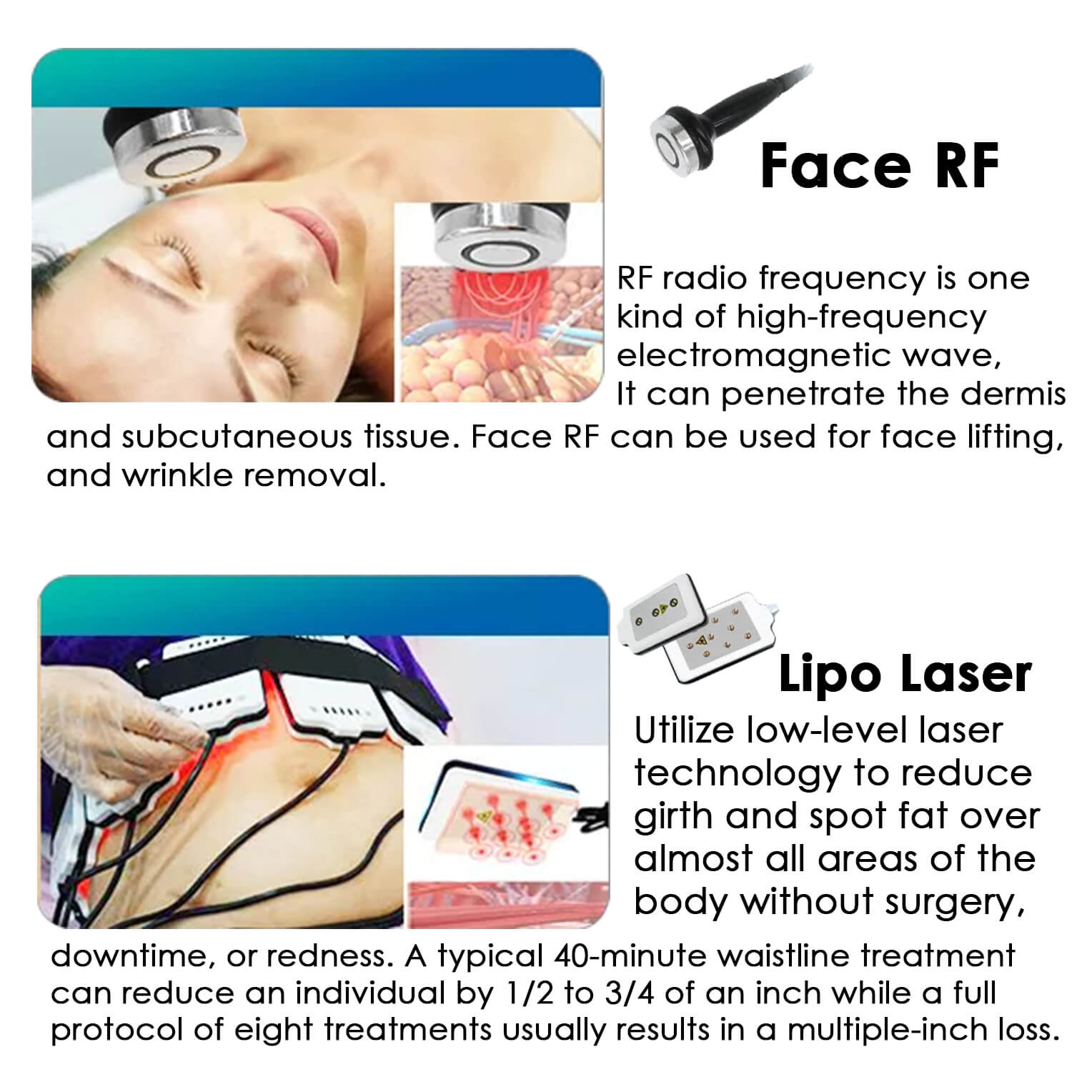 Cryo slimming machine comes with face rf and lipo laser handles